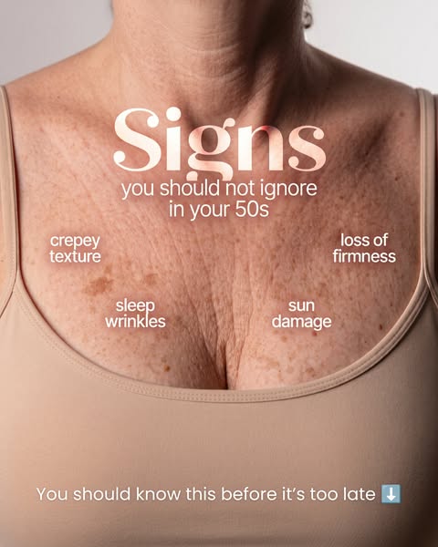 Besque ad creative